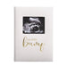White album with 'my little bump' text and ultrasound photo on a white background